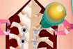 Jeu Anna Scoliosis Surgery